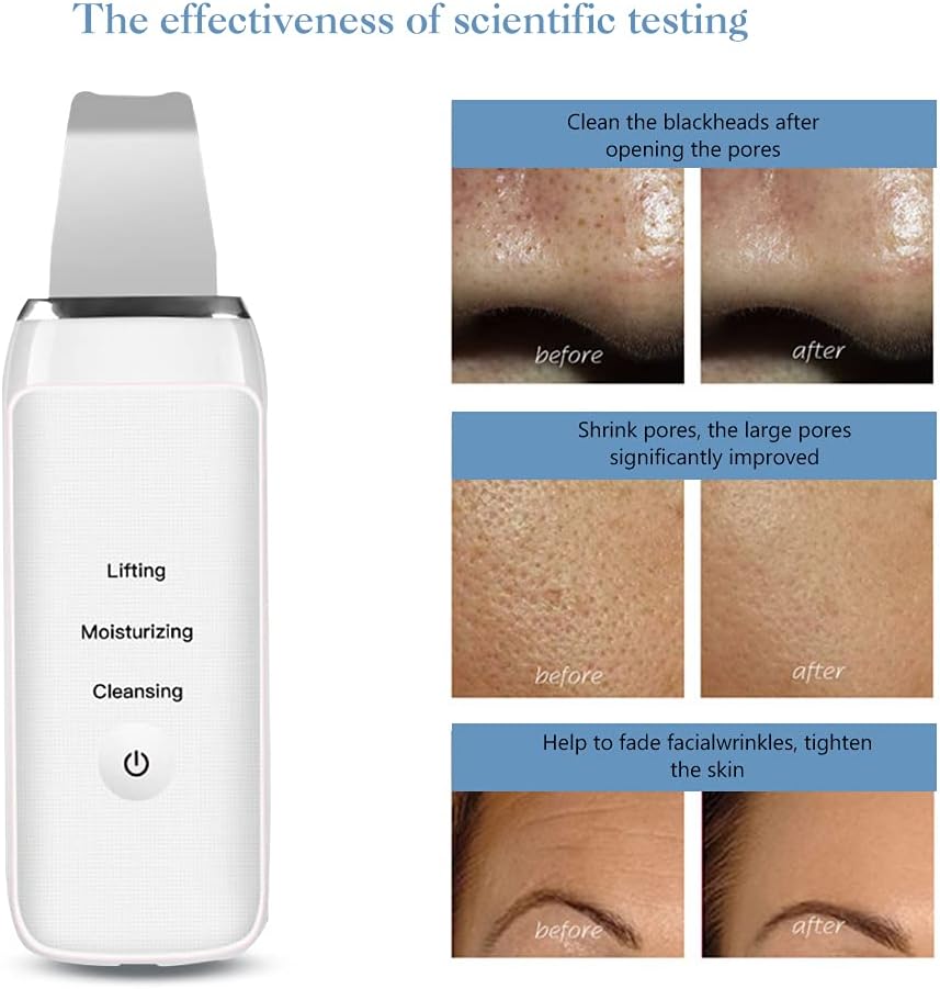 عرض العيد سوبر نعومة